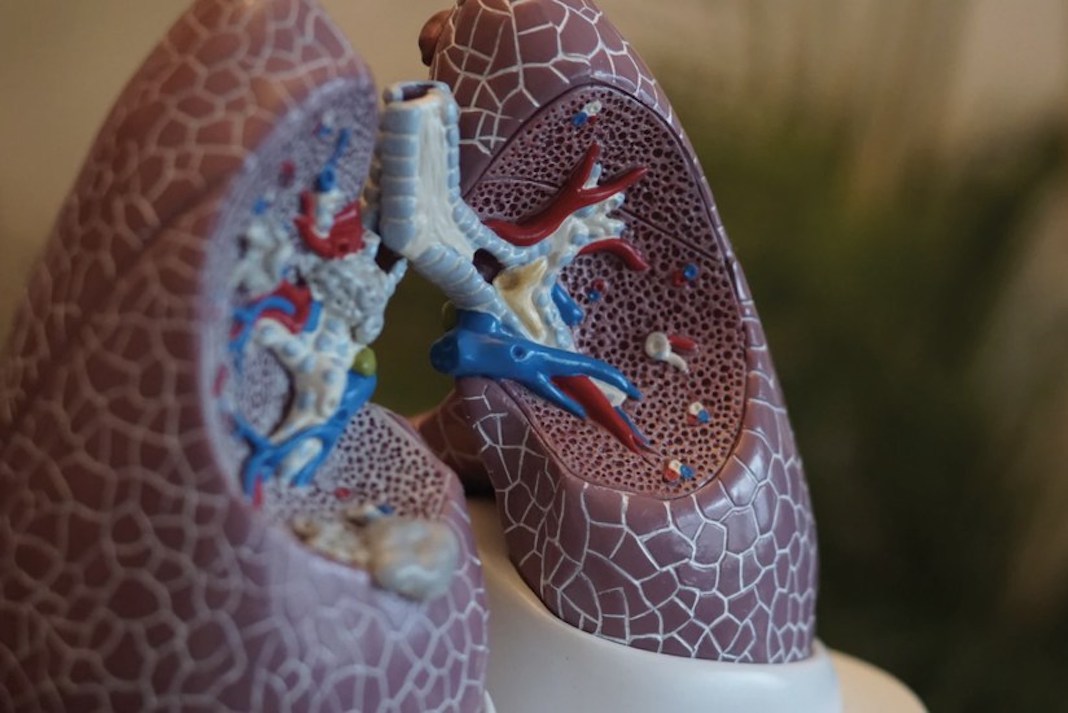 pulmones