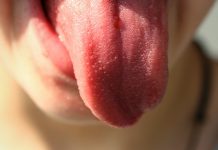 Cómo entrenar la lengua para mejorar el sueño con apnea