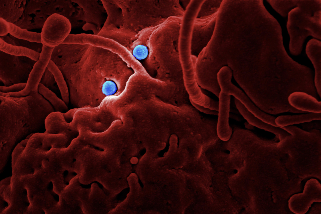 VIRUS