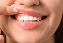 ¿Has sentido como un latigazo breve e intenso en los dientes tras tomar un café caliente?