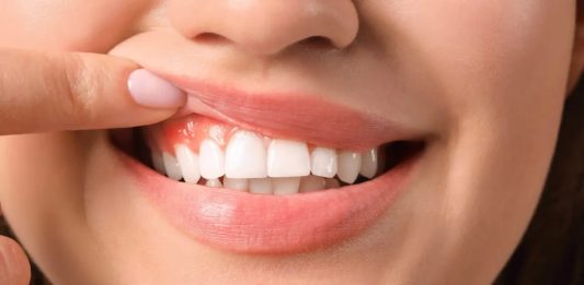 Cuidado con las bebidas ‘detox’, pueden dañar el esmalte dental