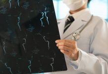 Alerta IMSS: Prevenir un derrame cerebral está en tus manos