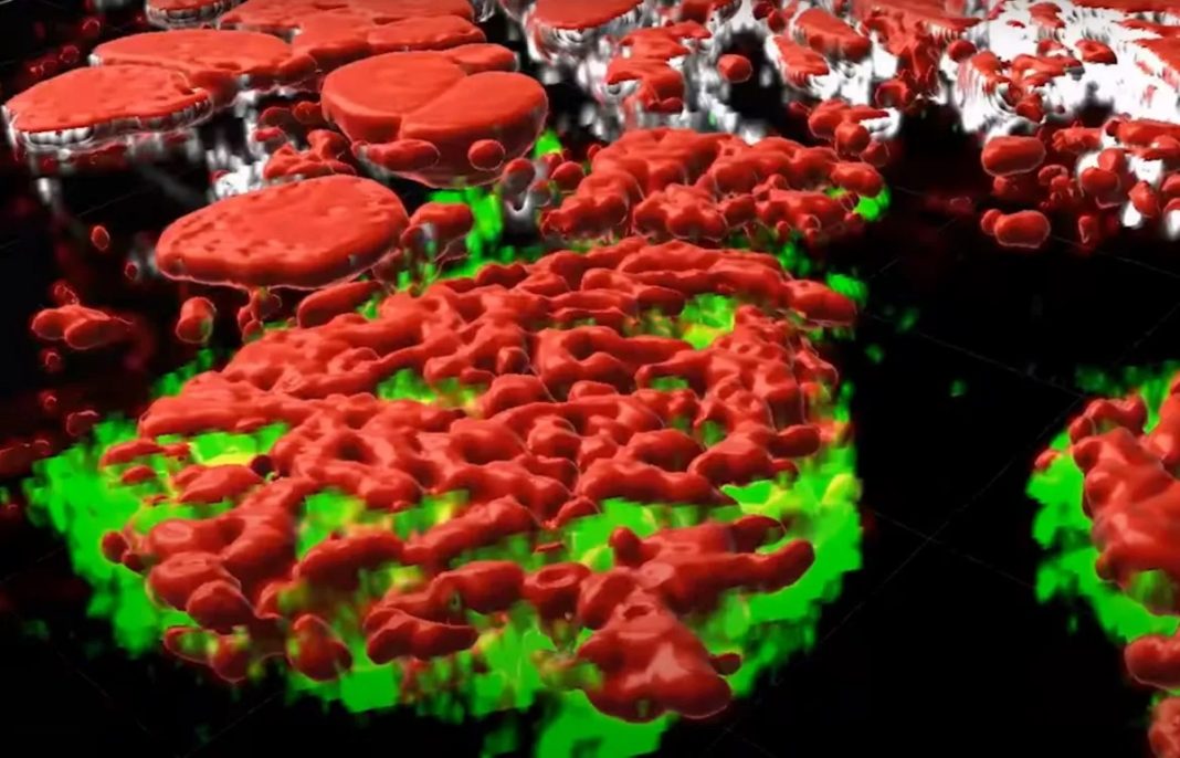 CANCER-3d