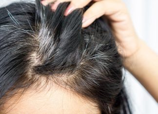 ¿Por qué salen canas a temprana edad?