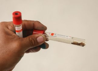 La plaga del gusano barrenador acecha a los humanos