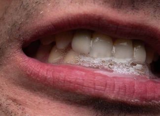 La saliva podría ayudar a predecir la evolución del cáncer de cabeza y cuello