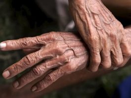 ¿Tiene fecha de caducidad nuestro cuerpo?